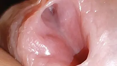 Amazing Glans